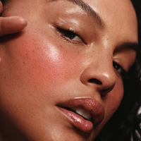 Freckle